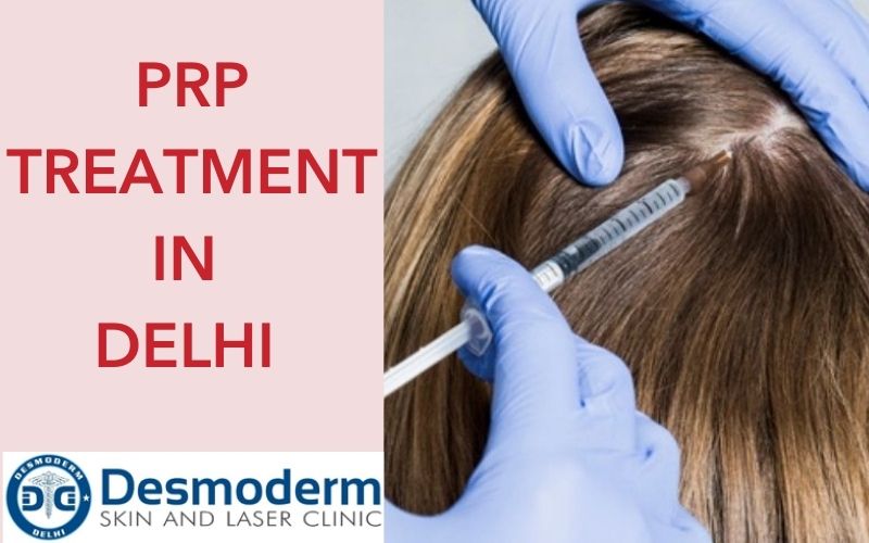 PRP Hair Treatment Success Rate ? | Desmoderm
