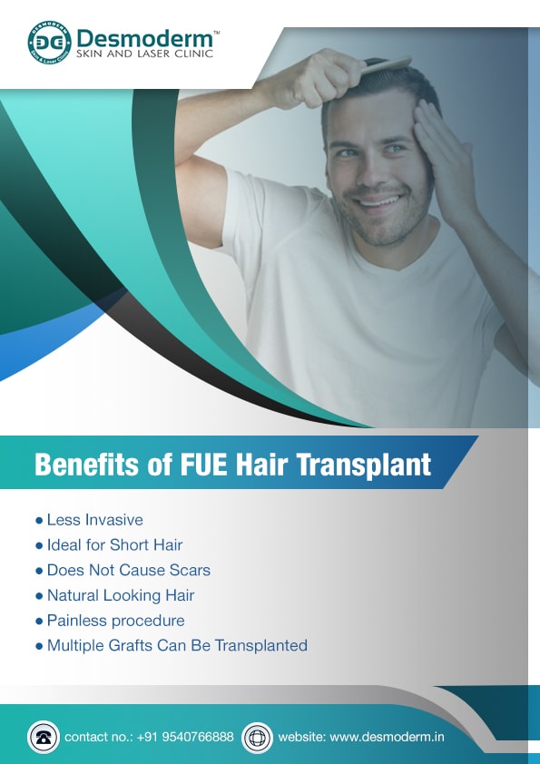 Benefits of Fue Hair Transplant