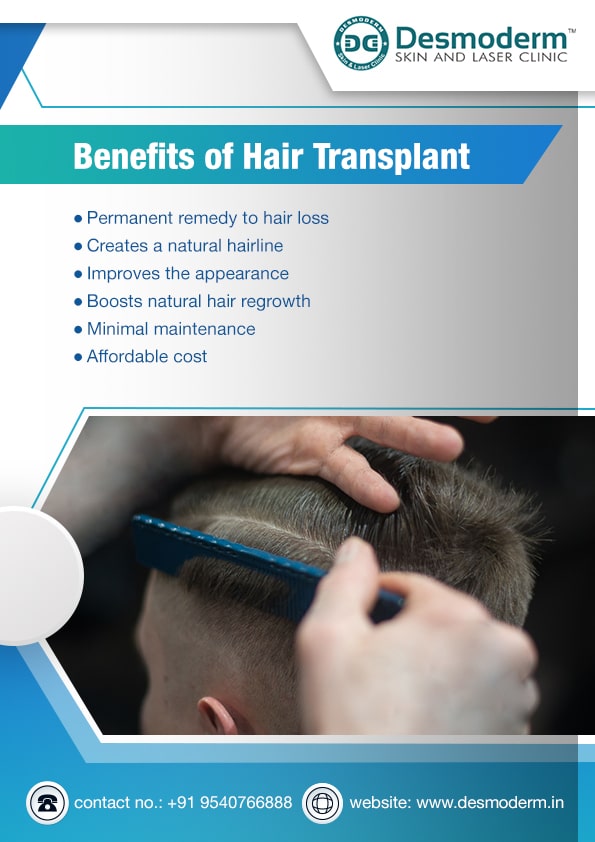Hair Transplant: Its Procedure, Recovery, and Cost | Desmoderm
