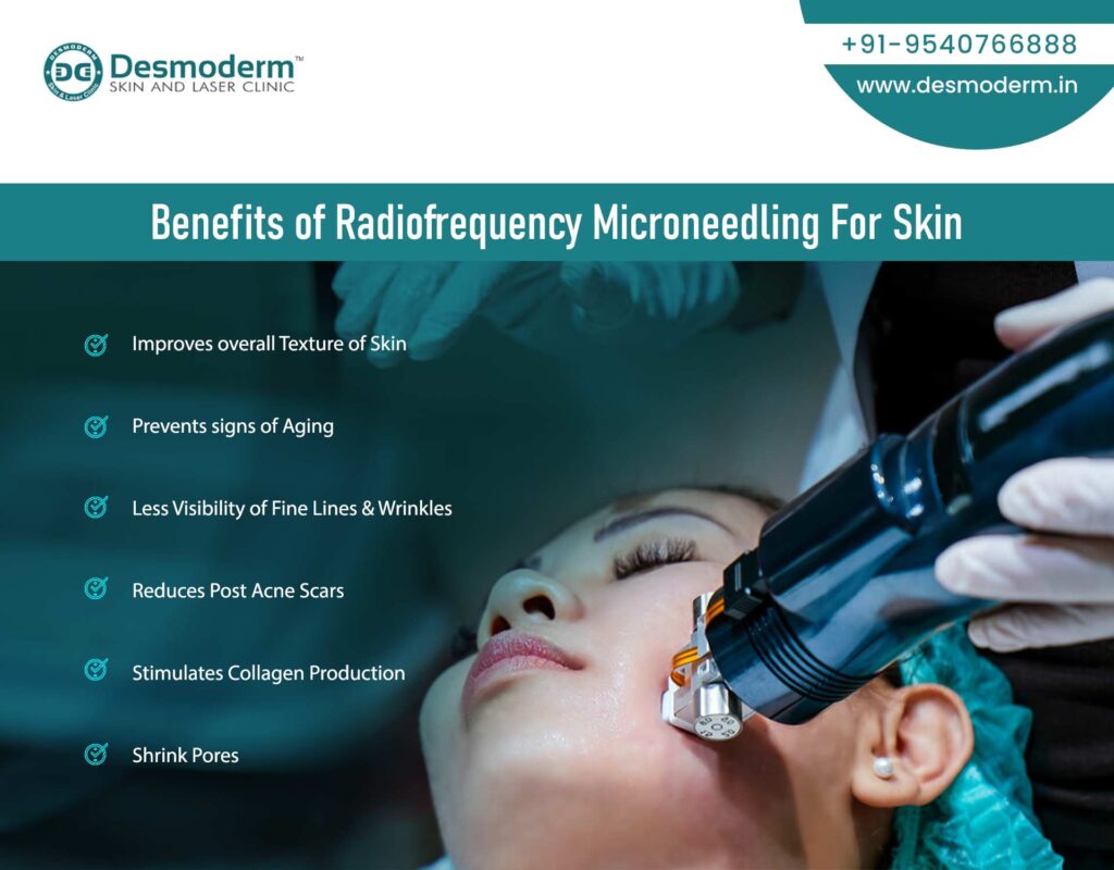 Radiofrequency micro-needling for skin