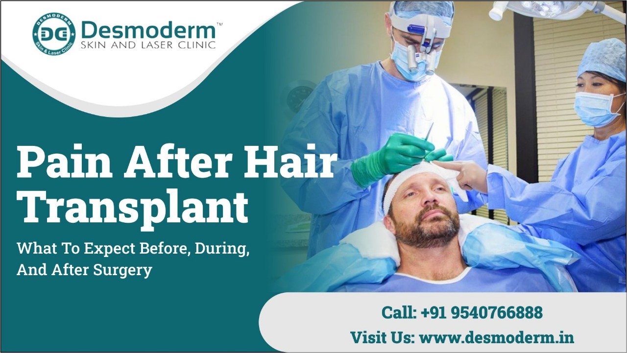 Pain After Hair Transplant Banner.