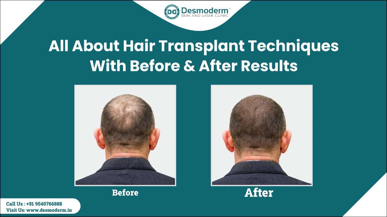 Before and after hair transplant: step-by-step situation