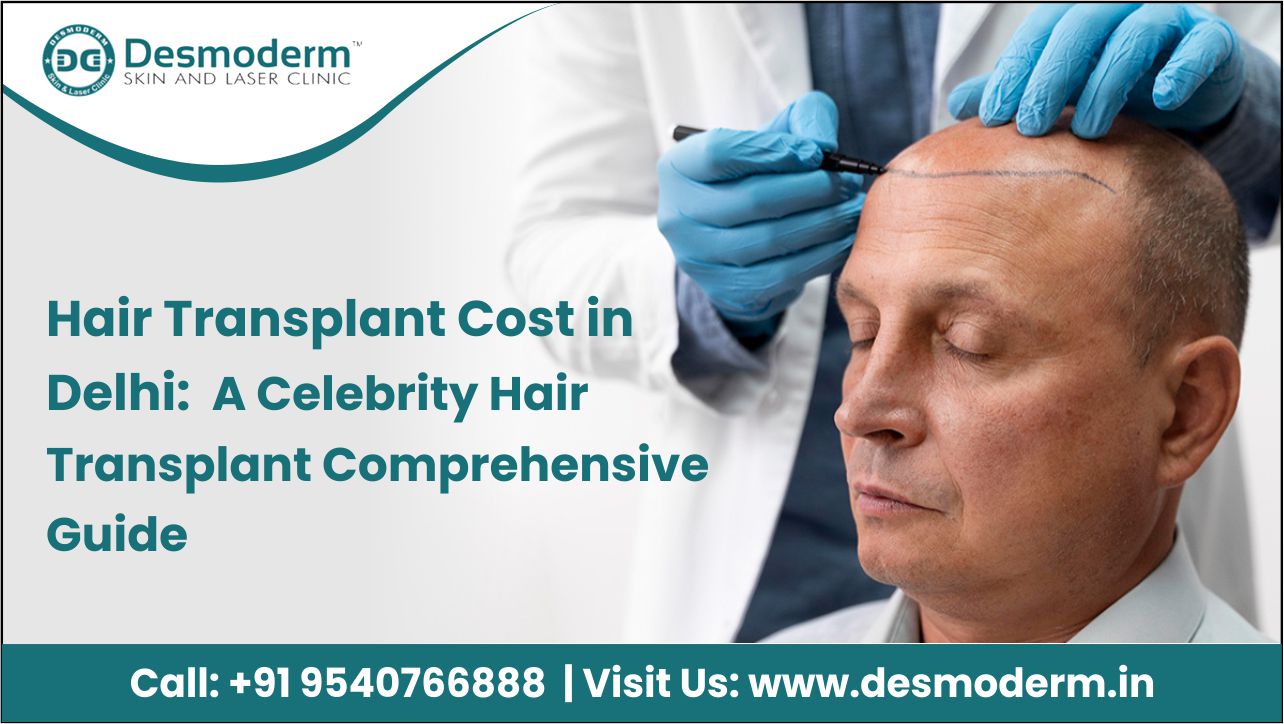 Hair Transplant Cost in Delhi: Celebrity Hair Transplant Understanding  Prices and Factors